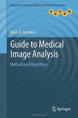 Cover for Toennies · Guide to Medical Image Analysi (Bog) (2012)