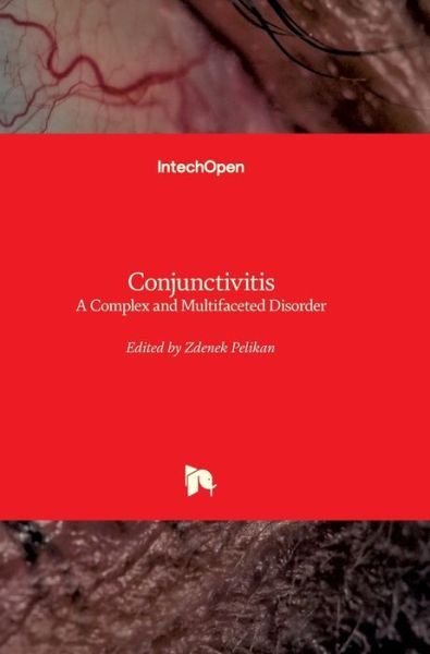 Cover for Zdenek Pelikan · Conjunctivitis: A Complex and Multifaceted Disorder (Hardcover bog) (2011)