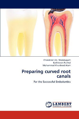 Cover for Mohammad Khursheed Alam · Preparing Curved Root Canals: for the Successful Endodontics (Paperback Book) (2012)
