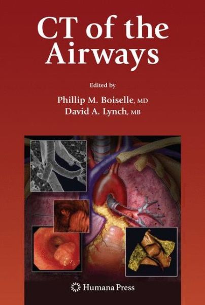 Cover for Phillip M Boiselle · CT of the Airways - Contemporary Medical Imaging (Paperback Book) [2008 edition] (2009)