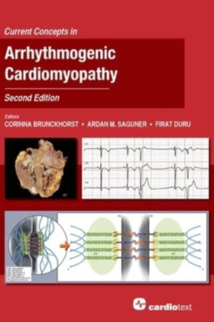 Cover for Corinna Brunckhorst · Current Concepts in Arrhythmogenic Cardiomyopathy, Second Edition (Hardcover Book) (2021)