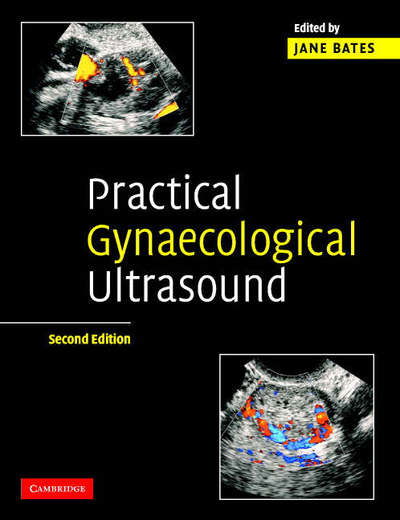 Practical Gynaecological Ultrasound - Jane Bates - Böcker - Cambridge University Press - 9780521674508 - 18 maj 2006