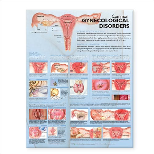 Cover for Acc · Common Gynecological Disorders Anatomical Chart (Landkarten) (2007)