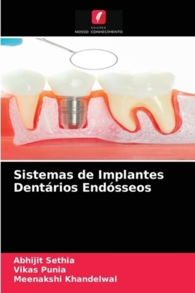 Cover for Abhijit Sethia · Sistemas de Implantes Dentarios Endosseos (Paperback Book) (2021)