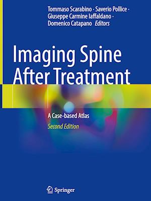 Imaging Spine After Treatment: A Case-based Atlas -  - Books - Springer International Publishing AG - 9783031425509 - January 17, 2024