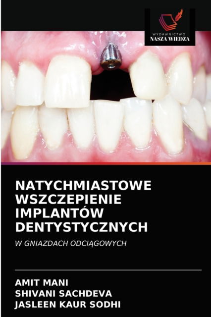 Cover for Amit Mani · Natychmiastowe Wszczepienie Implantow Dentystycznych (Paperback Book) (2021)