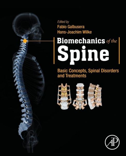 Cover for Fabio Galbusera · Biomechanics of the Spine: Basic Concepts, Spinal Disorders and Treatments (Paperback Book) (2018)