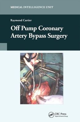 Cover for Raymond Cartier · Off-Pump Coronary Artery Bypass Surgery (Paperback Book) (2019)