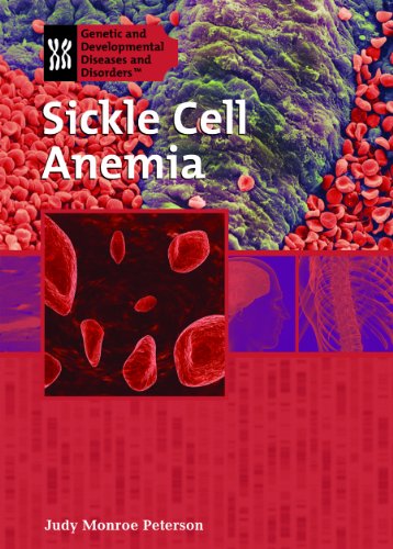 Cover for Judy Monroe Peterson · Sickle Cell Anemia (Genetic and Developmental Diseases and Disorders) (Hardcover Book) (2008)