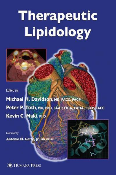 Cover for Therapeutic Lipidology - Contemporary Cardiology (Hardcover Book) [2007 edition] (2007)
