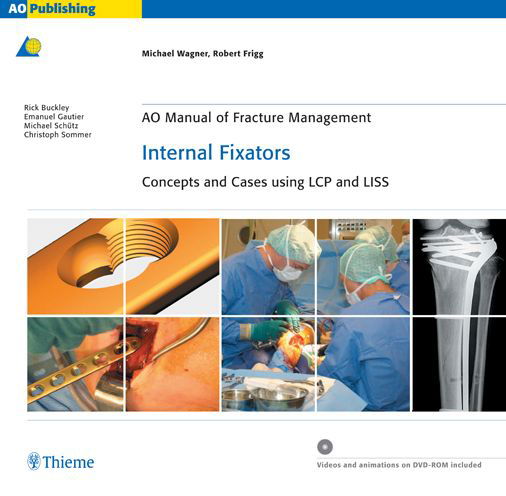 Cover for Michael Wagner · AO Manual of Fracture Management: Internal Fixators: Concepts and Cases using LCP / LISS (Gebundenes Buch) (2024)