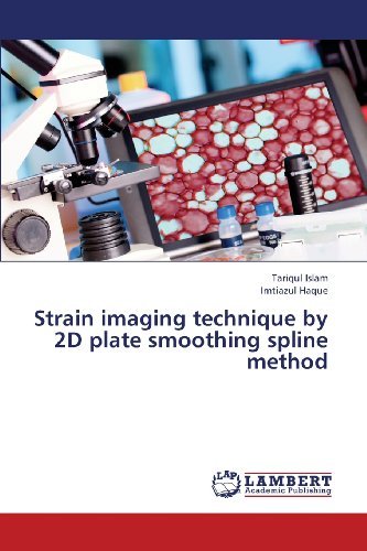 Cover for Imtiazul Haque · Strain Imaging Technique by 2d Plate Smoothing Spline Method (Paperback Book) (2013)