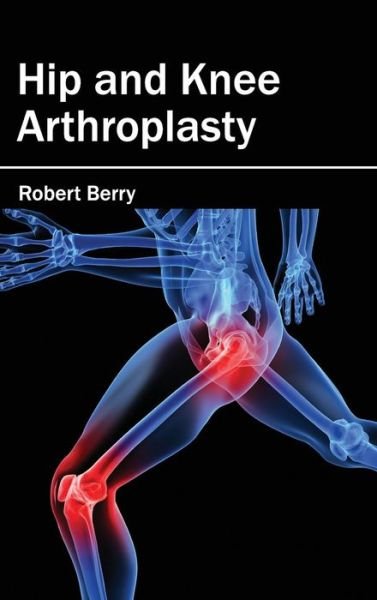 Cover for Robert Berry · Hip and Knee Arthroplasty (Hardcover bog) (2015)