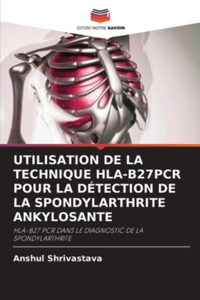 Cover for Anshul Shrivastava · Utilisation de la Technique Hla-B27pcr Pour La Detection de la Spondylarthrite Ankylosante (Paperback Book) (2021)