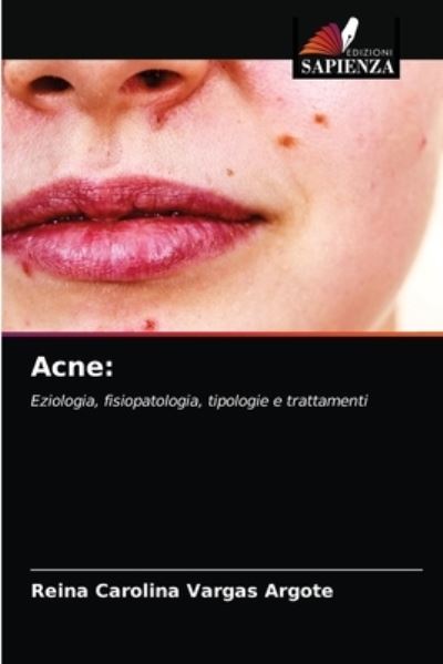 Cover for Reina Carolina Vargas Argote · Acne (Paperback Book) (2021)