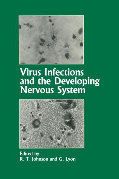 Cover for R T Johnson · Virus Infections and the Developing Nervous System (Pocketbok) [Softcover reprint of the original 1st ed. 1988 edition] (2012)