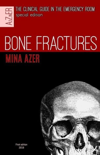 Cover for Mina Azer · Bone Fractures (Paperback Book) (2019)