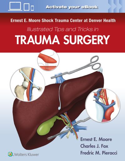 Ernest E. Moore Shock Trauma Center at Denver Health Illustrated Tips and Tricks in Trauma Surgery - Moore - Books - Wolters Kluwer Health - 9781975109516 - October 12, 2023