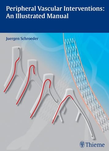 Peripheral Vascular Interventions: An Illustrated Manual - Jurgen Schroder - Books - Thieme Publishing Group - 9783131697516 - January 23, 2013