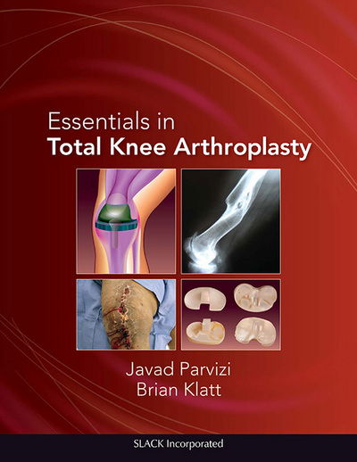 Cover for Javad Parvizi · Essentials in Total Knee Arthroplasty (Hardcover Book) (2011)