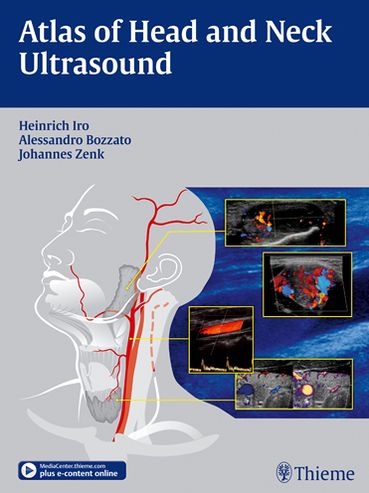 Cover for Heinrich Iro · Atlas of Head and Neck Ultrasound (Gebundenes Buch) (2013)