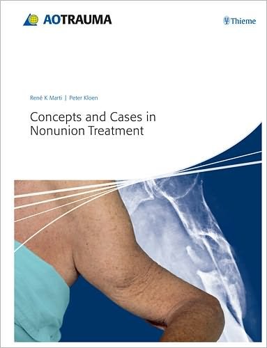 Concepts and Cases in Nonunion Treatment - Rene K. Marti - Libros - Thieme Publishing Group - 9783131658517 - 15 de junio de 2011