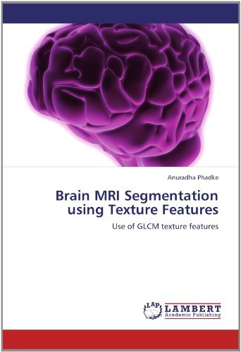 Cover for Anuradha Phadke · Brain Mri Segmentation Using Texture Features: Use of Glcm Texture Features (Paperback Book) (2012)