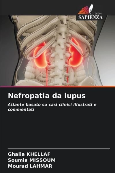 Cover for Ghalia Khellaf · Nefropatia da lupus (Paperback Book) (2021)