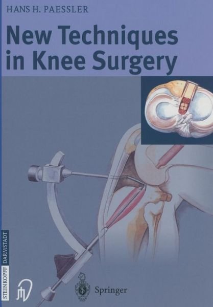 Cover for H.H. Paessler · New Techniques in Knee Surgery (Paperback Book) [Softcover reprint of the original 1st ed. 2003 edition] (2012)