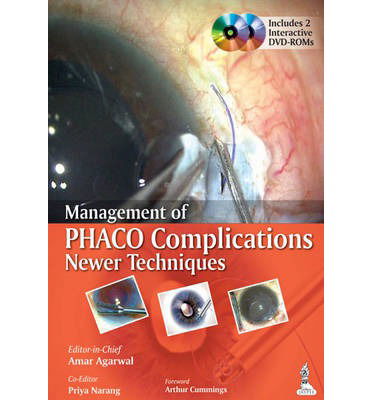 Cover for Amar Agarwal · Management of Phaco Complications: Newer Techniques (Paperback Book) (2014)