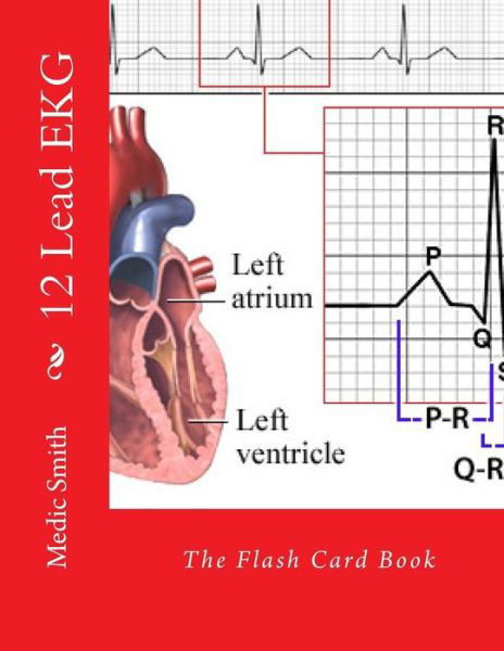 Cover for Medic Smith · 12 Lead Ekg: the Flash Card Book (Pocketbok) (2014)