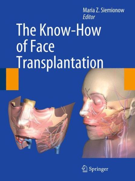 Cover for Maria Z Siemionow · The Know-How of Face Transplantation (Hardcover Book) (2011)