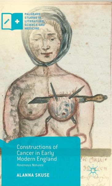 Cover for Alanna Skuse · Constructions of Cancer in Early Modern England: Ravenous Natures - Palgrave Studies in Literature, Science and Medicine (Hardcover Book) [1st ed. 2015 edition] (2015)