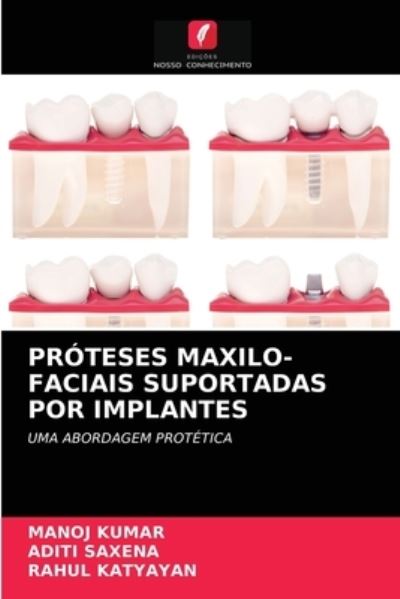 Cover for Kumar · Próteses Maxilo-faciais Suportada (N/A) (2021)