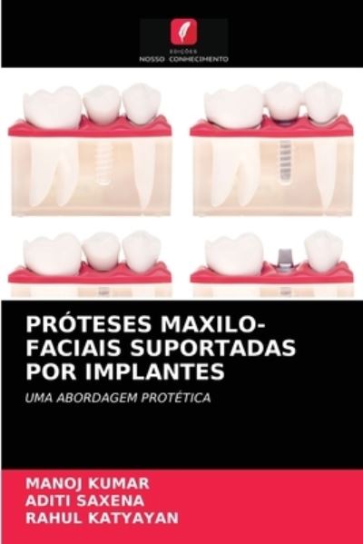 Próteses Maxilo-faciais Suportada - Kumar - Outro - - 9786203402520 - 10 de março de 2021