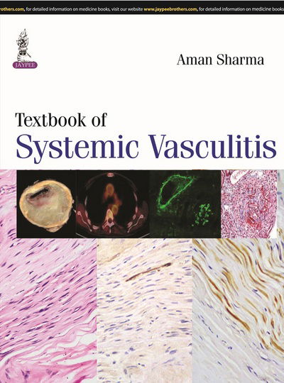 Cover for Aman Sharma · Textbook of Systemic Vasculitis (Inbunden Bok) (2015)