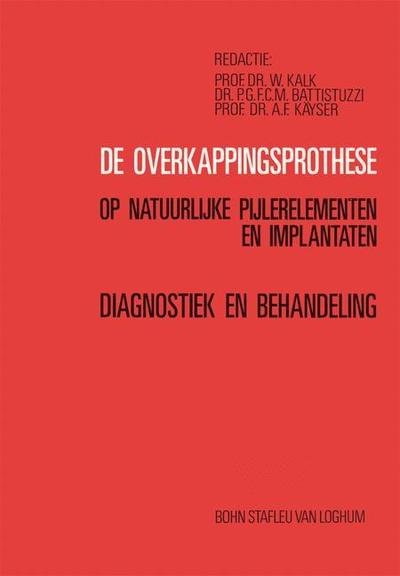 De Overkappingsprothese: Diagnostiek en Behandeling - Stroop Prof Dr N H J Creugers - Kirjat - Bohn Stafleu Van Loghum - 9789031311521 - keskiviikko 7. joulukuuta 1994