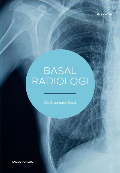 Cover for Ole Graumann (red.) · Basal radiologi 2. udg. (Gebundenes Buch) [2. Ausgabe] (2024)