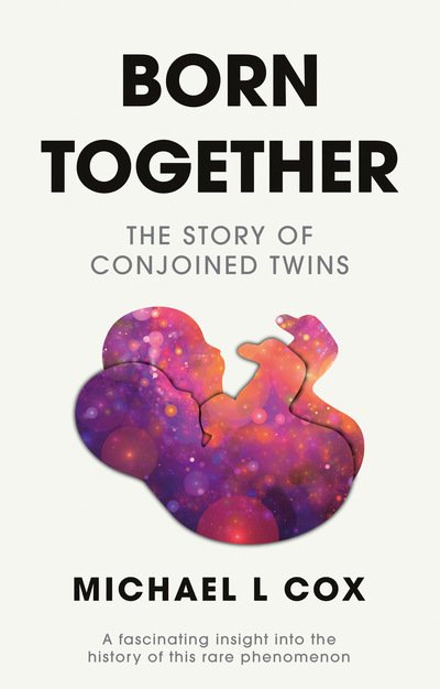 Born Together: The Story of Conjoined Twins - Michael L Cox - Libros - The Book Guild Ltd - 9781913208523 - 28 de julio de 2020