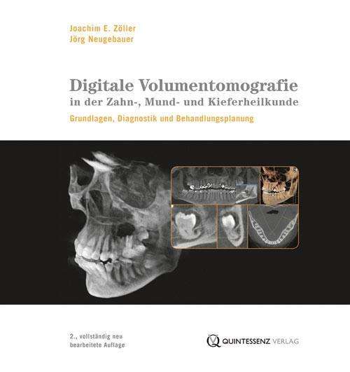 Cover for Zöller · Digitale Volumentomographie (Book)