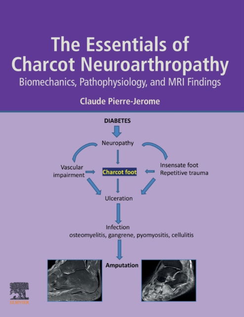 Cover for Pierre-Jerome, Claude (Associate Research Professor, Oslo University Hospital, Oslo, Norway) · The Essentials of Charcot Neuroarthropathy: Biomechanics, Pathophysiology, and MRI Findings (Paperback Book) (2022)
