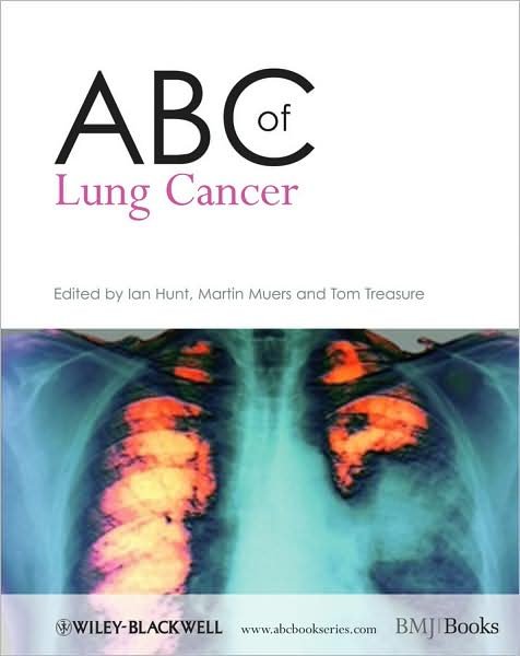 Cover for Ian Hunt · ABC of Lung Cancer - ABC Series (Paperback Book) (2009)