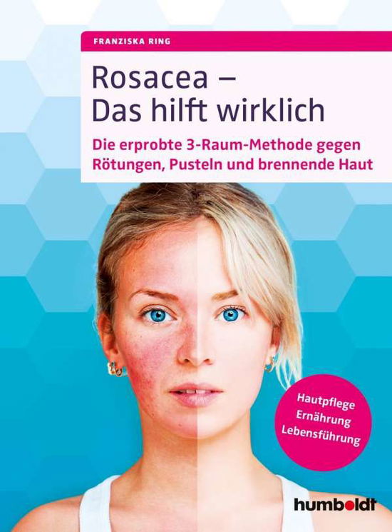 Cover for Ring · Rosacea - Das hilft wirklich (Bok)