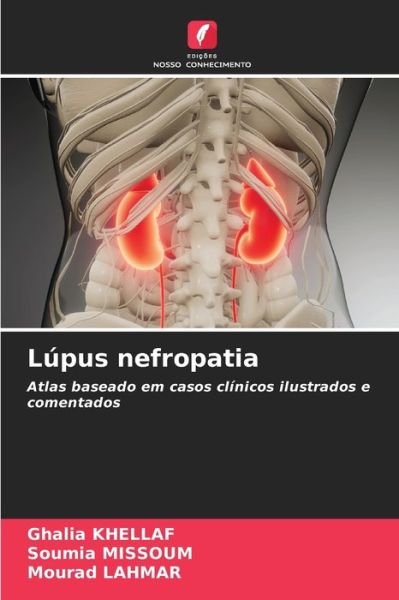 Cover for Ghalia Khellaf · Lupus nefropatia (Pocketbok) (2021)
