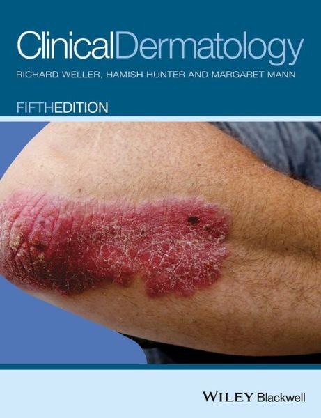 Cover for Weller, Richard B. (Senior Lecturer, Department of Dermatology, University of Edinburgh, Edinburgh, UK) · Clinical Dermatology (Pocketbok) (2015)