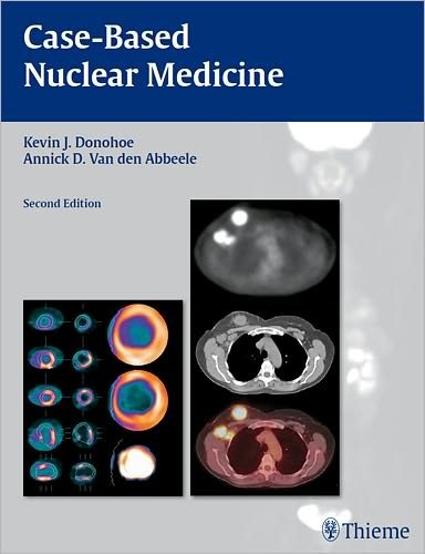 Cover for Kevin J. Donohoe · Case-Based Nuclear Medicine (Taschenbuch) [2 New edition] (2011)