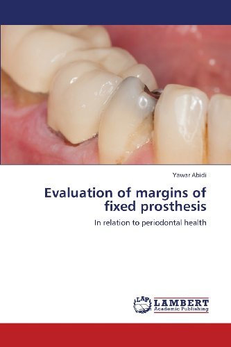 Cover for Yawar Abidi · Evaluation of Margins of Fixed Prosthesis: in Relation to Periodontal Health (Paperback Bog) (2013)