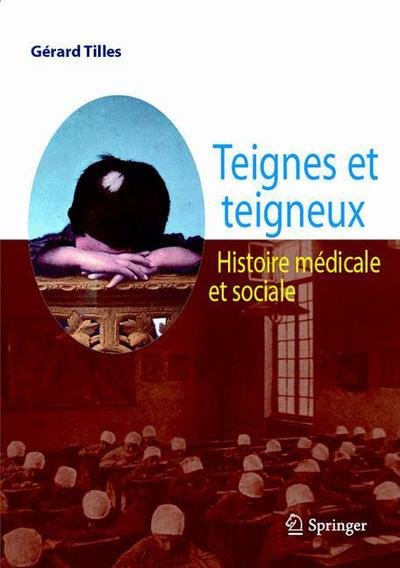 Teignes et teigneux: Histoire medicale et sociale - Gerard Tilles - Livros - Springer Paris - 9782287878527 - 16 de dezembro de 2008