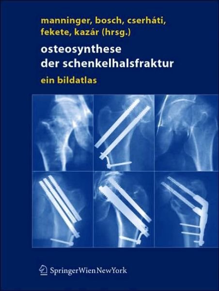 Osteosynthese der schenkelhalsfraktur: ein bildatlas - 9783211272480 - Boeken - Springer Verlag GmbH - 9783211201527 - 6 december 2004