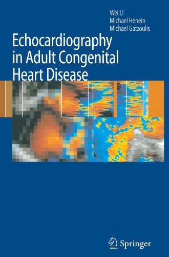 Cover for Wei Li · Echocardiography in Adult Congenital Heart Disease (Taschenbuch) [Softcover reprint of hardcover 1st ed. 2007 edition] (2010)